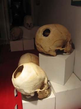 Skulls
